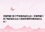 手指甲被门夹了严重有淤血怎么办（手指甲被门夹了有淤血怎么办,门夹到手指甲内有淤血怎么办）