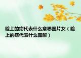 脸上的痣代表什么意思图片女（脸上的痣代表什么图解）