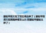 脚趾甲剪太短了然后旁边肿了（脚趾甲剪得太短周围肿着怎么办,剪脚趾甲脚趾头肿了）