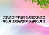 艾灸烫伤和水泡怎么处理艾灸烫伤怎么处理艾灸烫伤和水泡怎么处理