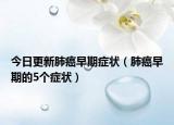 今日更新肺癌早期症状（肺癌早期的5个症状）
