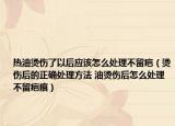 热油烫伤了以后应该怎么处理不留疤（烫伤后的正确处理方法 油烫伤后怎么处理不留疤痕）