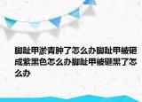 脚趾甲淤青肿了怎么办脚趾甲被砸成紫黑色怎么办脚趾甲被砸黑了怎么办