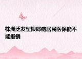 株洲泛发型银屑病居民医保能不能报销