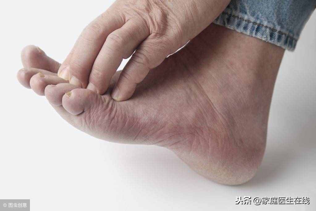 治疗冻疮有妙方！送你4个方法，皮肤不再瘙痒难忍