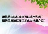 晒伤后皮肤红痛痒可以涂水乳吗（晒伤后皮肤红痛痒怎么办详细介绍）