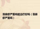 荨麻疹严重吗能治疗好吗（荨麻疹严重吗）