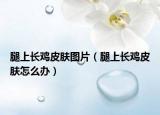 腿上长鸡皮肤图片（腿上长鸡皮肤怎么办）
