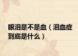 眼泪是不是血（泪血症到底是什么）