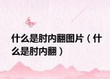 什么是肘内翻图片（什么是肘内翻）