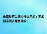 鱼尾纹可以通过什么手术（手术能不能去除鱼尾纹）