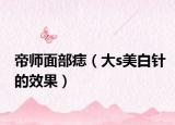 帝师面部痣（大s美白针的效果）