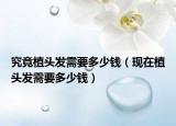 究竟植头发需要多少钱（现在植头发需要多少钱）