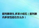 前列腺增生,多发小结石（前列腺内多发性结石怎么办）