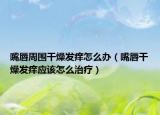 嘴唇周围干燥发痒怎么办（嘴唇干燥发痒应该怎么治疗）