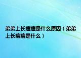 弟弟上长痘痘是什么原因（弟弟上长痘痘是什么）