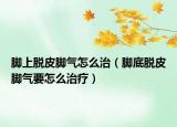 脚上脱皮脚气怎么治（脚底脱皮脚气要怎么治疗）