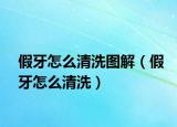 假牙怎么清洗图解（假牙怎么清洗）