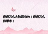 痤疮怎么去除最有效（痤疮怎么做手术）