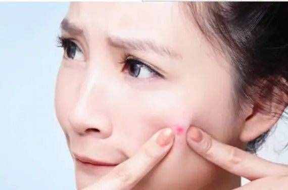痘痘长在不同位置，代表不同器官出问题了？