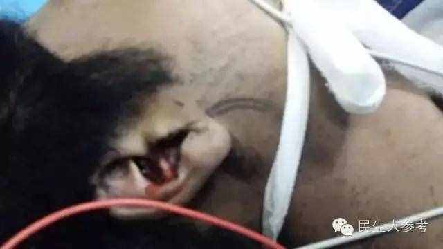 惋惜！开封28岁男子今晨接电话时，被雷劈身亡！