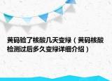 黄码验了核酸几天变绿（黄码核酸检测过后多久变绿详细介绍）