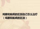 鸡眼和跖疣的区别自己怎么治疗（鸡眼和跖疣的区别）