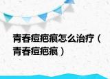 青春痘疤痕怎么治疗（青春痘疤痕）