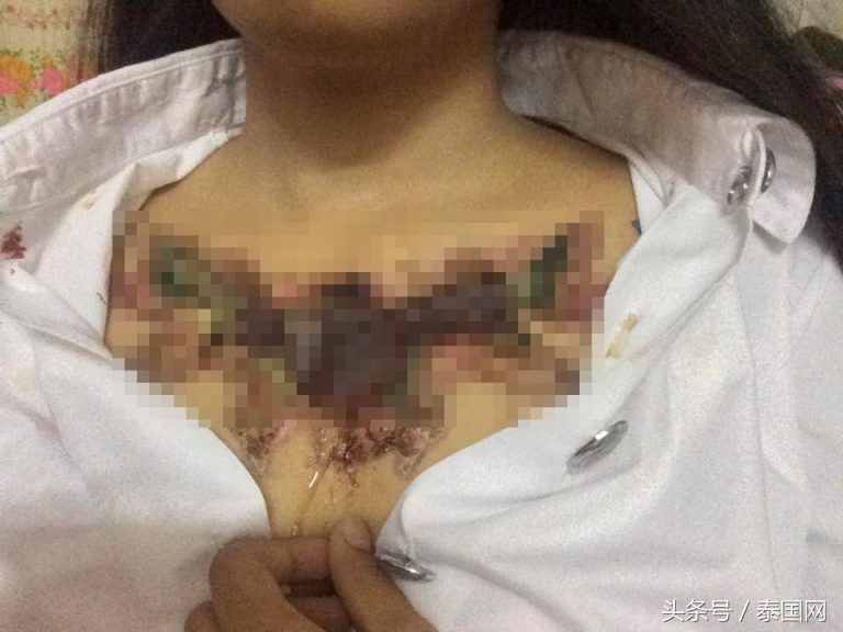 泰国女大学生洗纹身，结果变这样