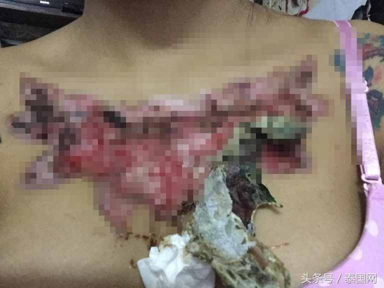 泰国女大学生洗纹身，结果变这样