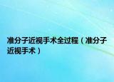 准分子近视手术全过程（准分子近视手术）
