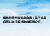 做核酸检测会流鼻血吗（鼻子流鼻血可以做核酸检测吗详细介绍）