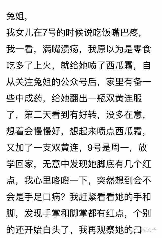 小柴胡加双黄连治疗手足口病