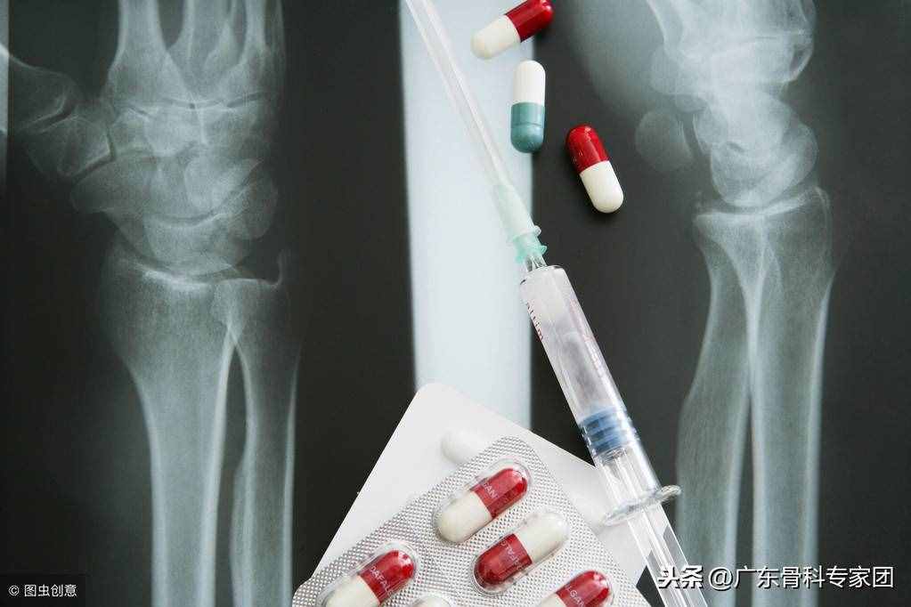 滑膜炎的症状有哪些？有这几个表现警惕病情很严重了
