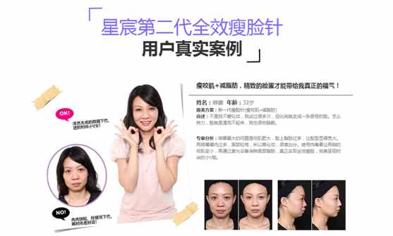 瘦脸针多少钱一次？