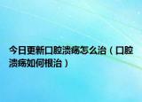 今日更新口腔溃疡怎么治（口腔溃疡如何根治）