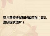 婴儿湿疹症状和过敏区别（婴儿湿疹症状图片）