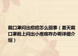 戴口罩闷出痘痘怎么回事（夏天戴口罩脸上闷出小疙瘩咋办呢详细介绍）