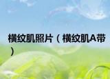 横纹肌照片（横纹肌A带）