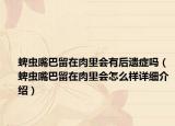 蜱虫嘴巴留在肉里会有后遗症吗（蜱虫嘴巴留在肉里会怎么样详细介绍）