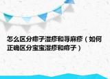怎么区分痱子湿疹和荨麻疹（如何正确区分宝宝湿疹和痱子）