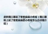 皮肤戴口罩起了密密麻麻小疙瘩（戴口罩脸上起了密密麻麻的小疙瘩怎么办详细介绍）