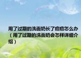用了过期的洗面奶长了痘痘怎么办（用了过期的洗面奶会怎样详细介绍）