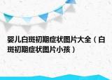 婴儿白斑初期症状图片大全（白斑初期症状图片小孩）
