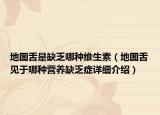 地图舌是缺乏哪种维生素（地图舌见于哪种营养缺乏症详细介绍）