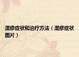 湿疹症状和治疗方法（湿疹症状图片）