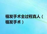 植发手术全过程真人（植发手术）