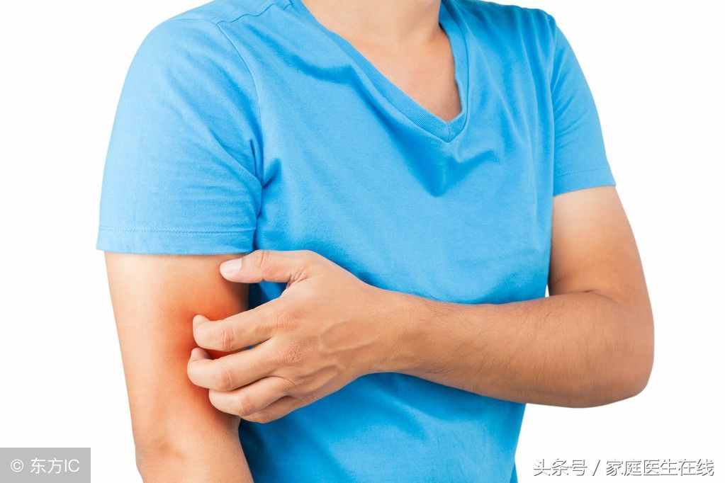 被虫子叮咬怎么办？这4种处理方法，收藏后必有用