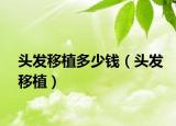 头发移植多少钱（头发移植）