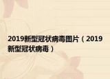 2019新型冠状病毒图片（2019新型冠状病毒）